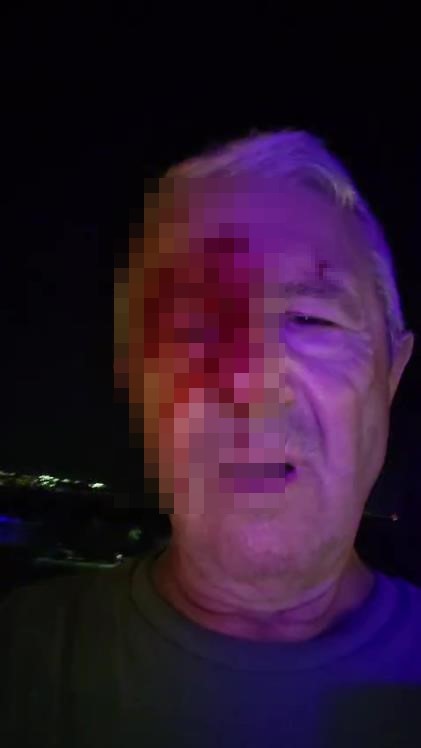 KOCAELİ – Kocaeli’de haber için gittiği olay yerinde iki şahsın